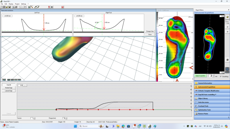 Insole modeling software - easyCAD insole - Sensor Medica